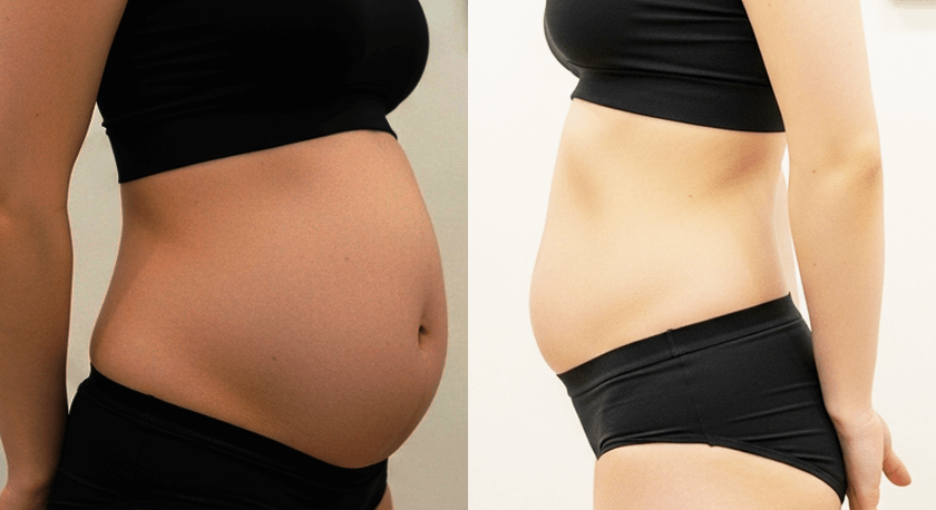 短期経過、撮影条件の統一なし